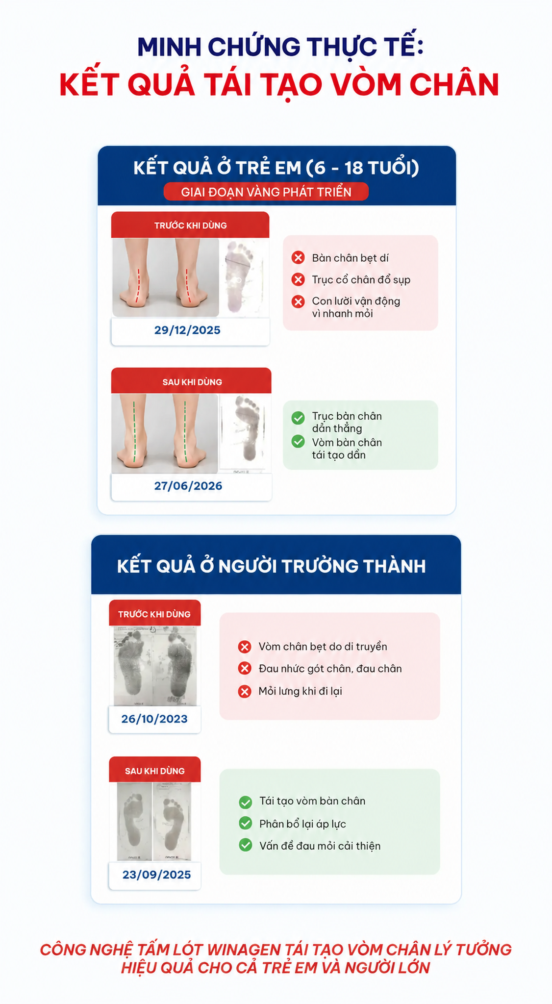 Minh chứng thực tế – Kết quả tái tạo vòm chân