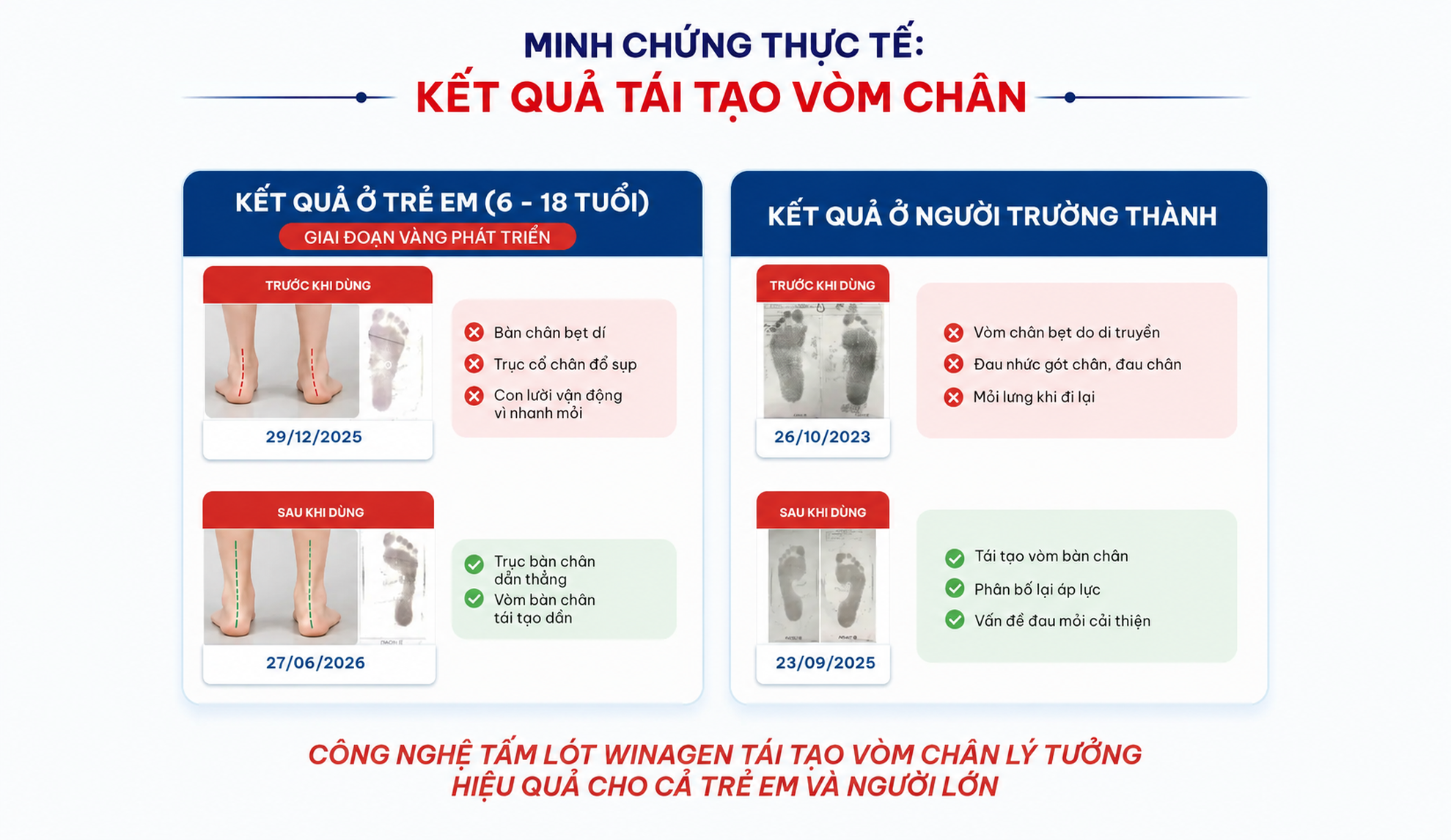 Minh chứng thực tế – Kết quả tái tạo vòm chân